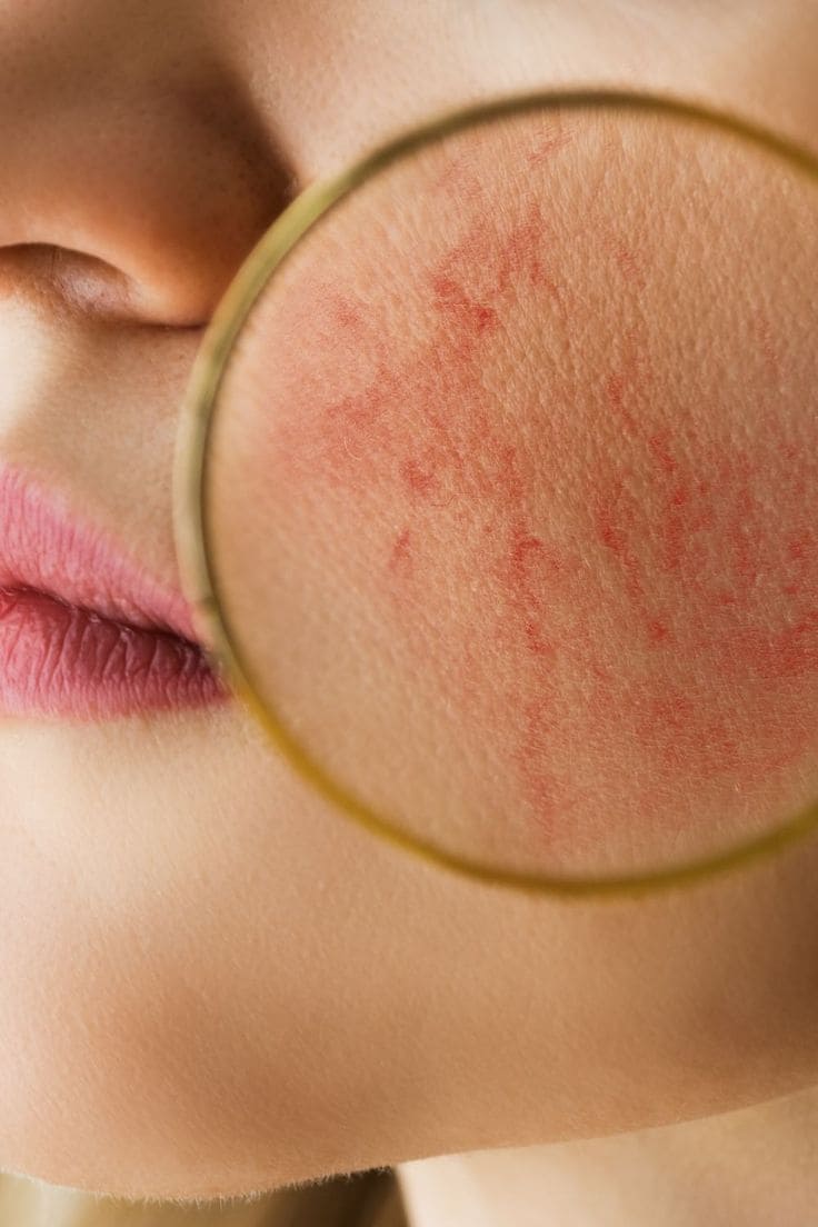 Top Những Điều Cần Quan Tâm Đến Chăm Sóc Da Trước Khi Đi Biển - Tránh xa những “quân thù” của da trước chuyến đi