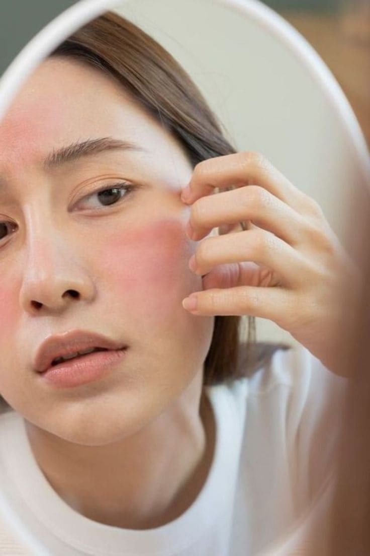 Tại Sao Da "Khóc Thầm" Sau Chuyến Đi Biển?