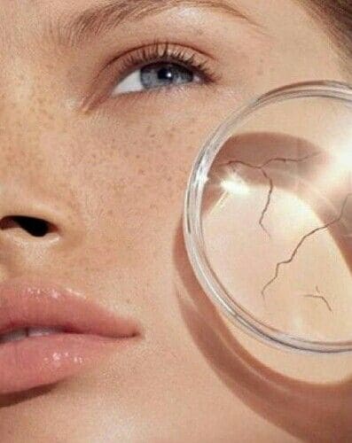 Tại Sao Da "Khóc Thầm" Sau Chuyến Đi Biển?